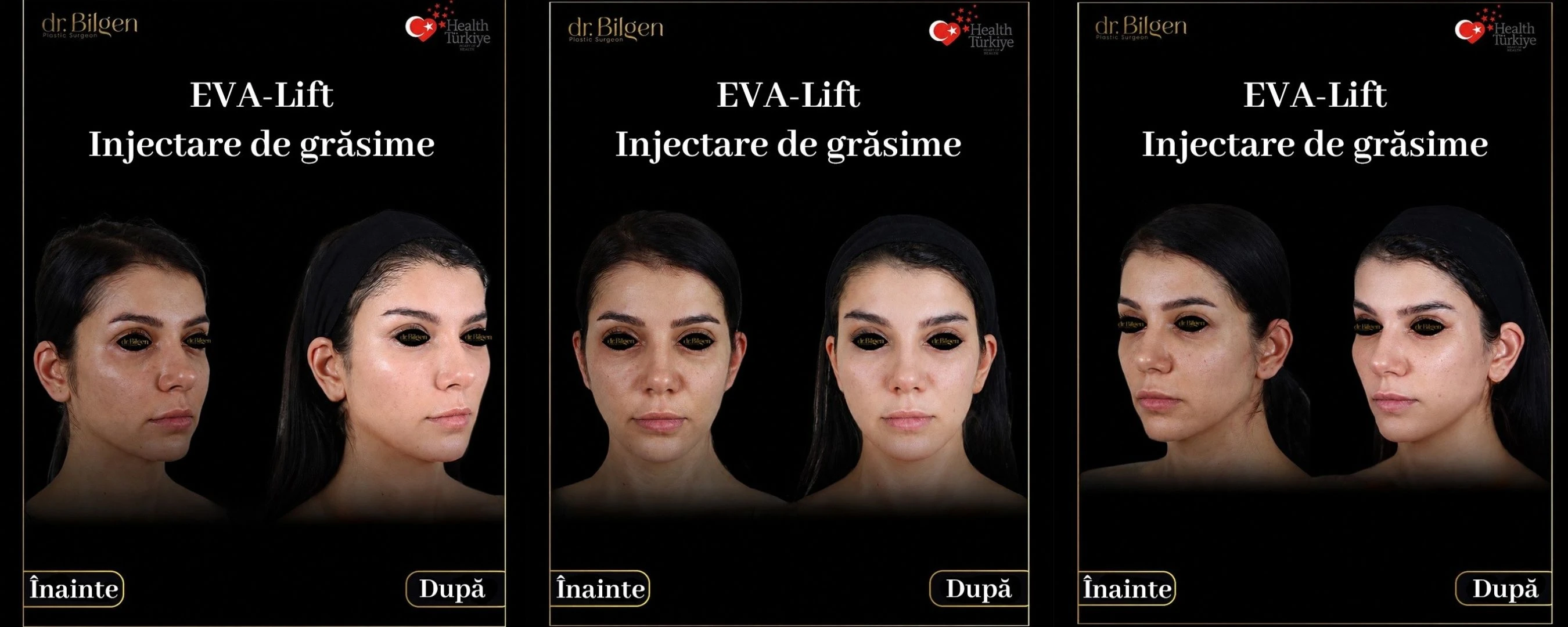 Op. Dr. BİLGEN KATİPOĞLU ERENOĞLU