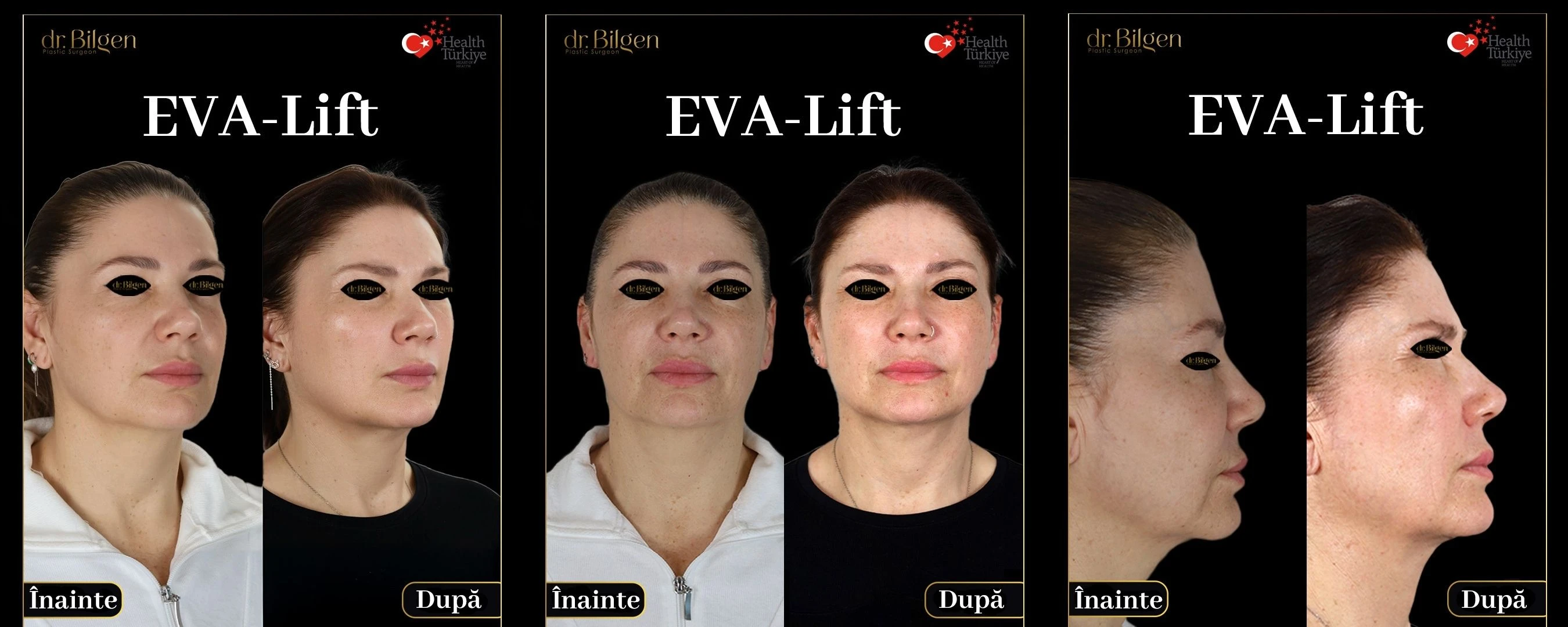 Op. Dr. BİLGEN KATİPOĞLU ERENOĞLU