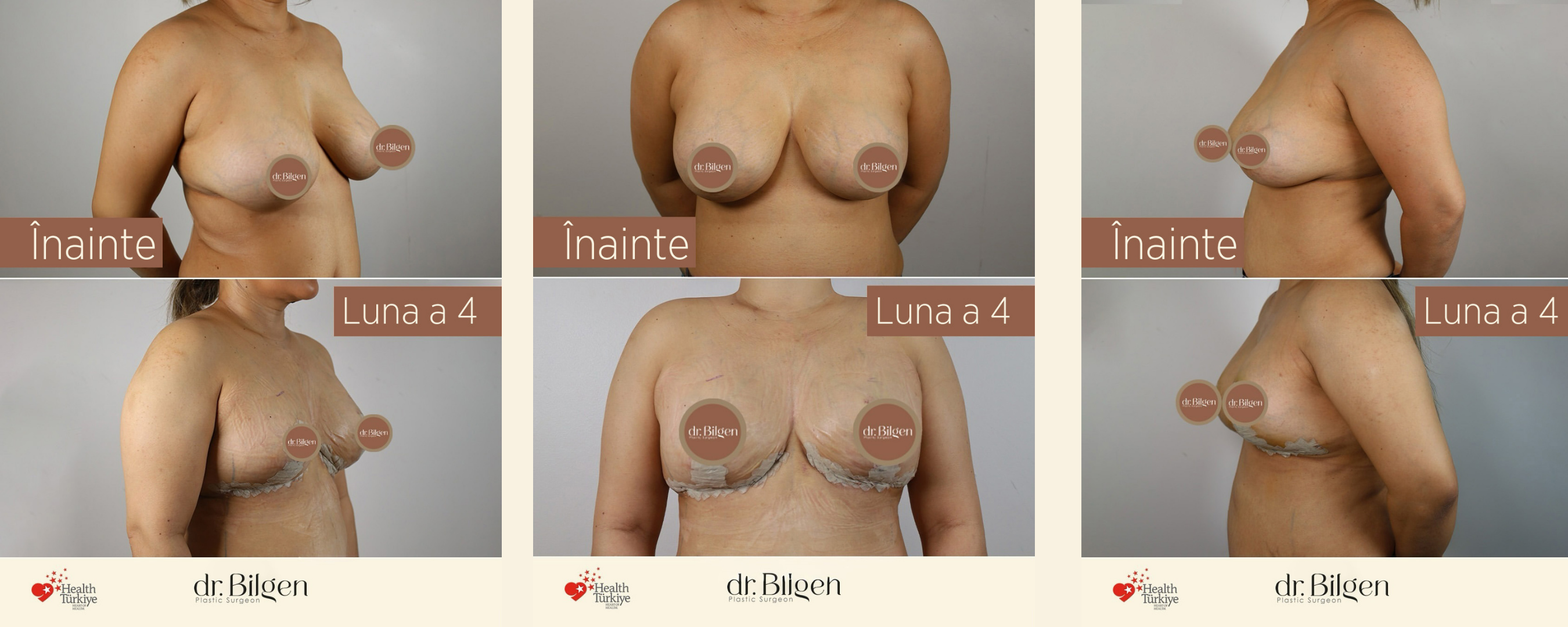 Op. Dr. BİLGEN KATİPOĞLU ERENOĞLU