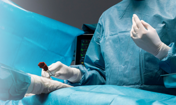 Transplant de păr